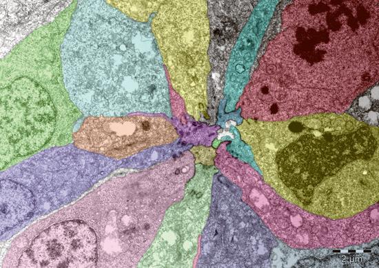 As a zebrafish embryo develops, the cells that will form its lateral line have to become pointed at one end and arrange themselves around a central, unchanged cell, forming a rosette. This microscopy image shows one such rosette, magnified approximately 10,000 times. (Credit: Virginie Lecaudey / EMBL) As a zebrafish embryo develops, the cells that will form its lateral line have to become pointed at one end and arrange themselves around a central, unchanged cell, forming a rosette. This microscopy image shows one such rosette, magnified approximately 10,000 times. (Credit: Virginie Lecaudey / EMBL)