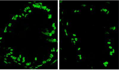 Sections of zebrafish intestines show more proliferating cells (in green) in fish reared in the presence of microbes, left, versus those reared under sterile conditions at right. (Credit: Courtesy of Karen Guillemin) Sections of zebrafish intestines show more proliferating cells (in green) in fish reared in the presence of microbes, left, versus those reared under sterile conditions at right. (Credit: Courtesy of Karen Guillemin)