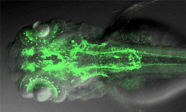 Colored overall view of a zebrafish nervous system. (Credit: Driever and Ryu) Colored overall view of a zebrafish nervous system. (Credit: Driever and Ryu)