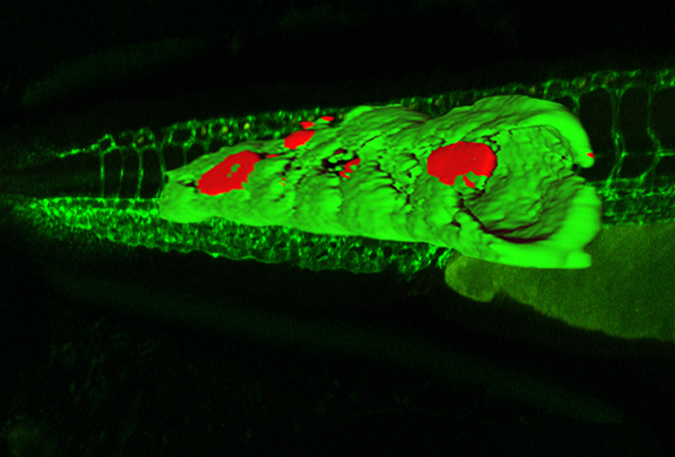 This zebrafish was engineered to carry a fluorescent antibody that binds to bad cholesterol. Credit: UC San Diego School of Medicine This zebrafish was engineered to carry a fluorescent antibody that binds to bad cholesterol. Credit: UC San Diego School of Medicine